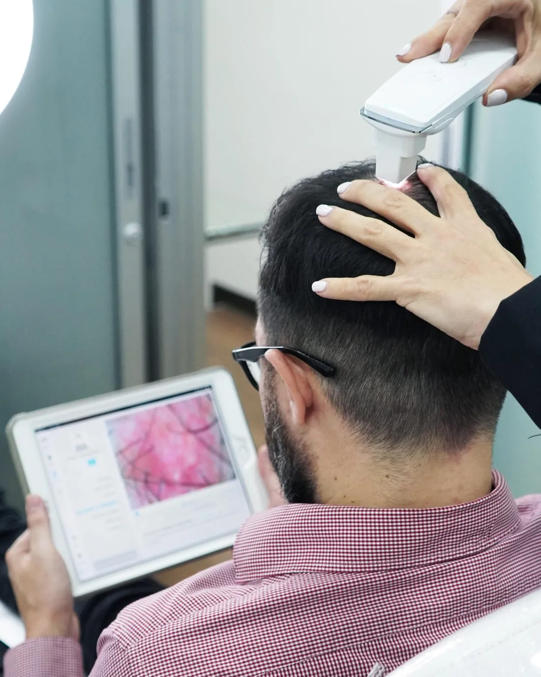 SmartHair assessment at La Clínica del Pelo